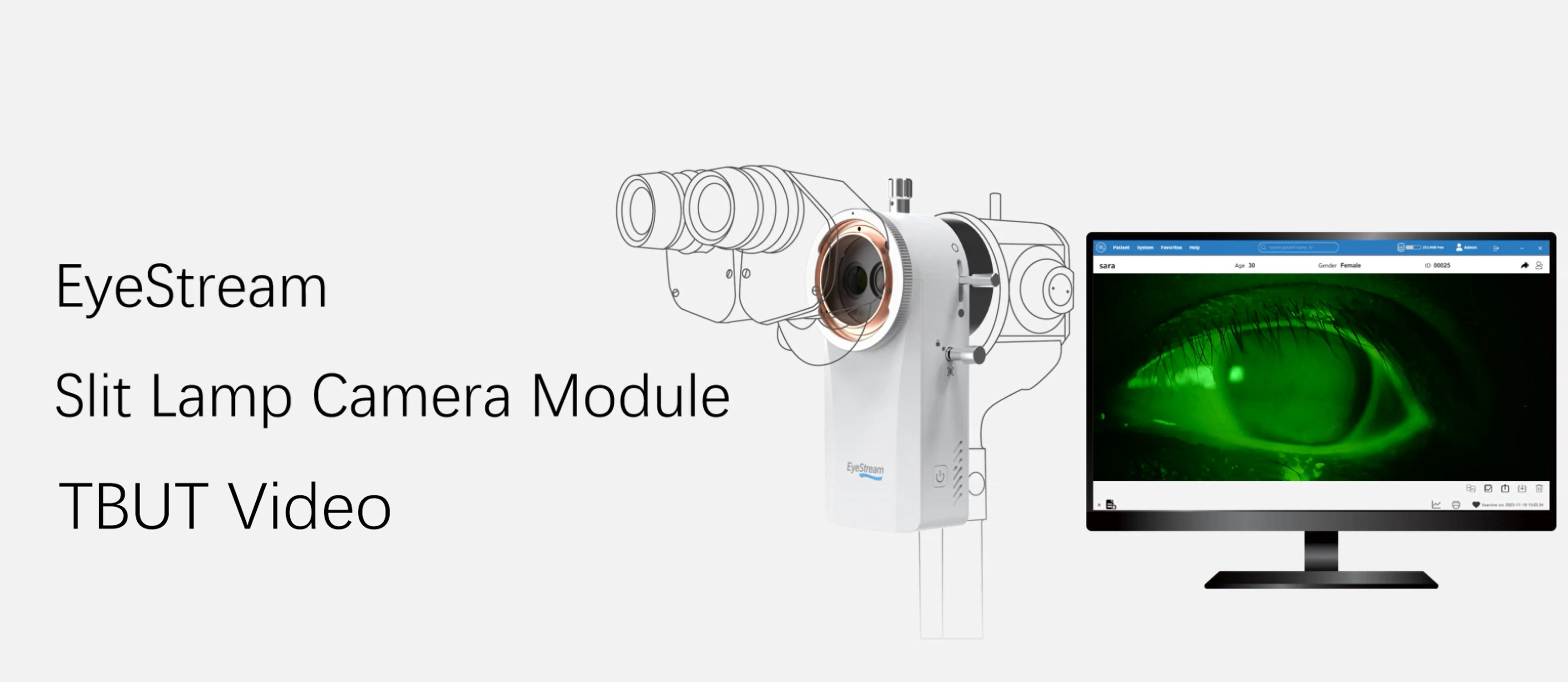 المصباح الشقي TBUT: التقاط الاتجاهات وقياسها وتتبعها باستخدام EyeStream وVisuDoc