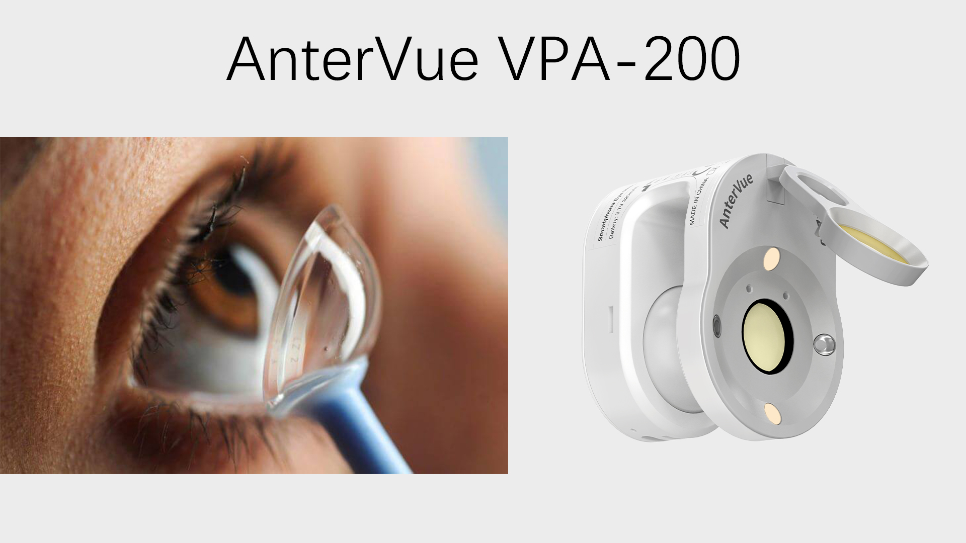 Четыре случая: что AnterVue Imaging может помочь вам показать