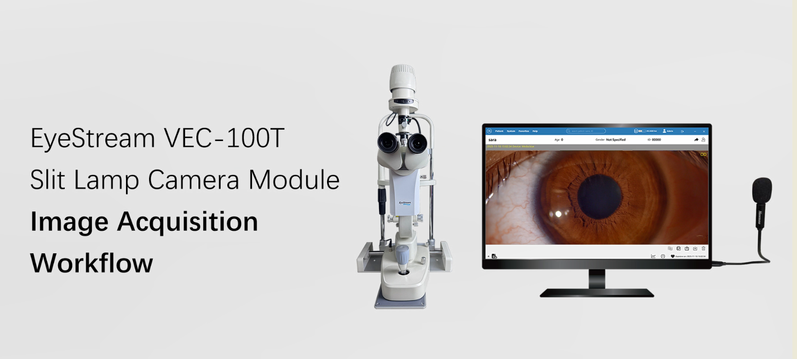 How EyeStream Fits Into a Slit-Lamp Imaging Workflow